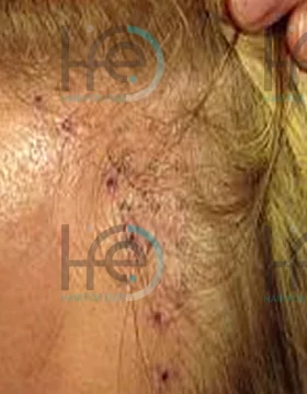До