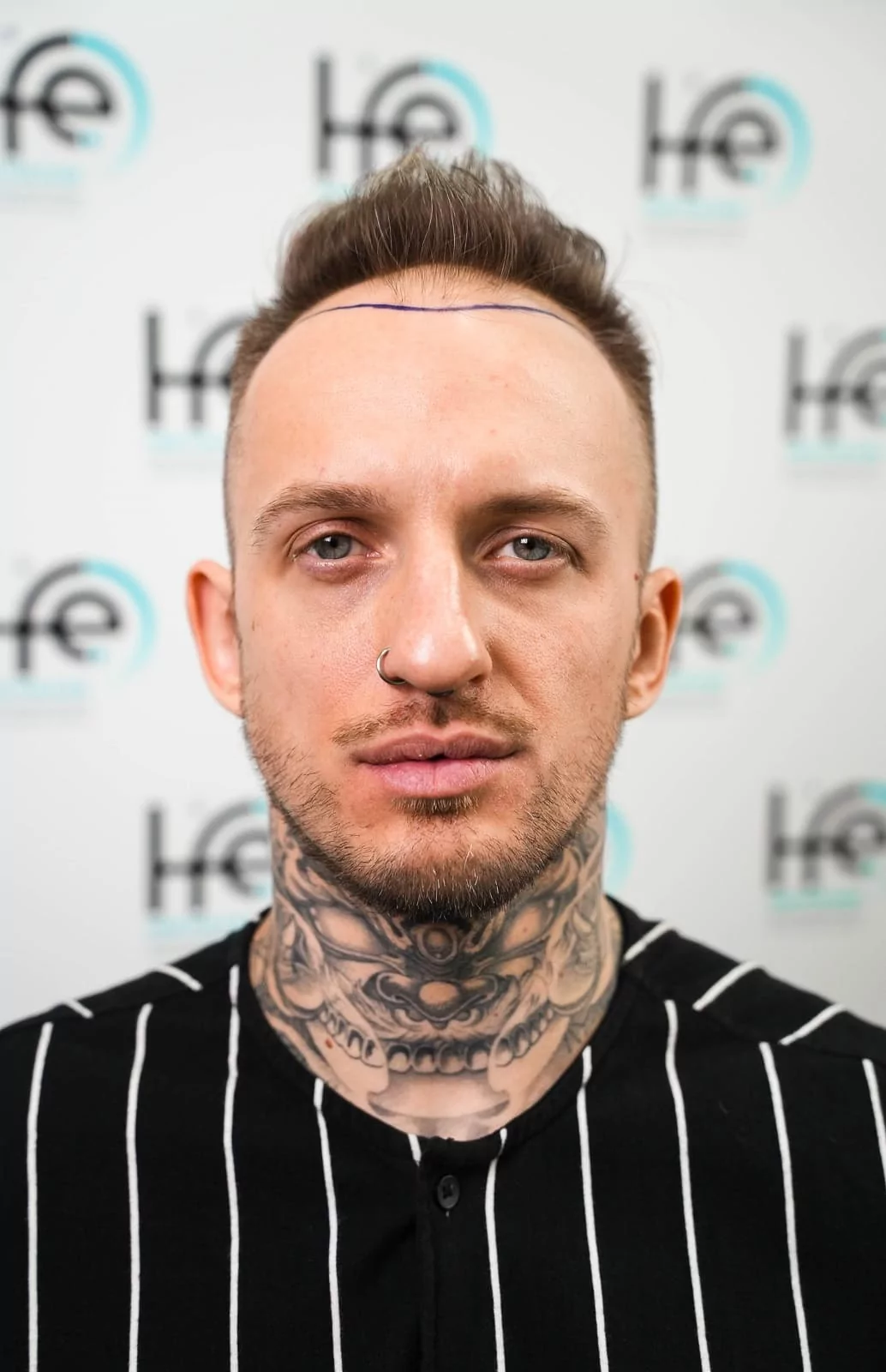 Консультация в клинике HFE