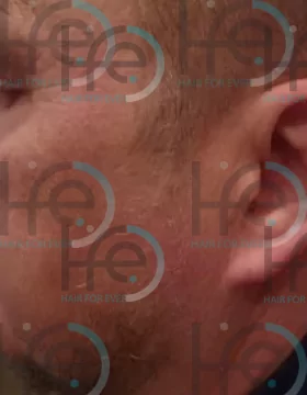 До