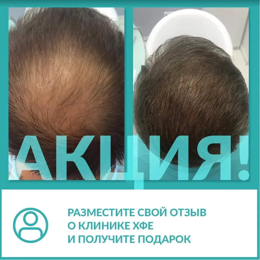Размести свой отзыв о клинике HFE!