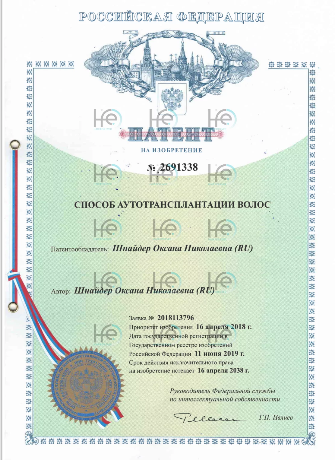 Патент на способ аутотрансплантации волос 