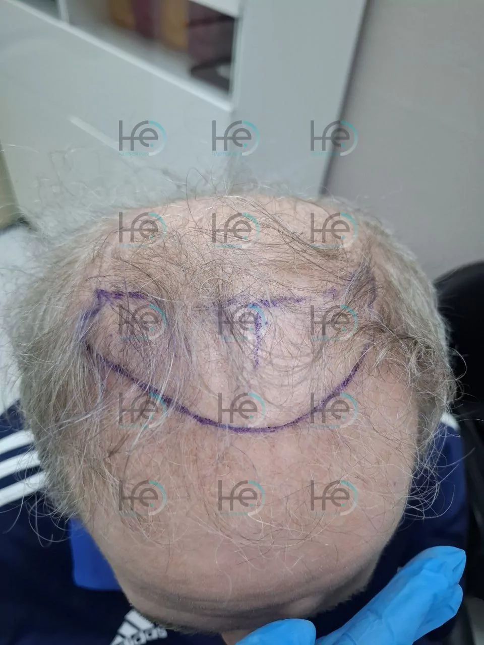 до