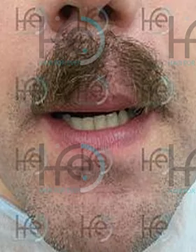 До