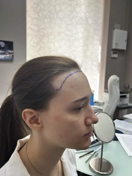 Пациентка до процедуры_2