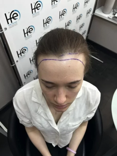 Пациентка до процедуры_1