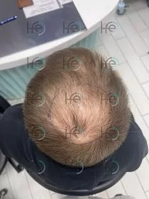 До