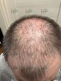 До