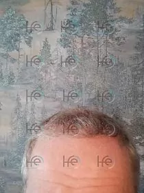 После