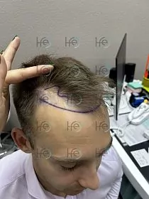 До