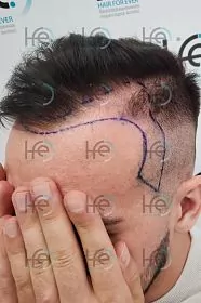 До