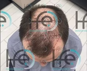 До