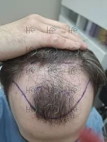 До