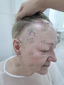 До