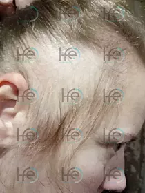 До