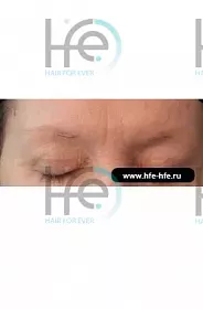 До