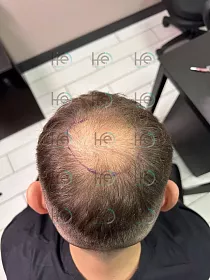 До